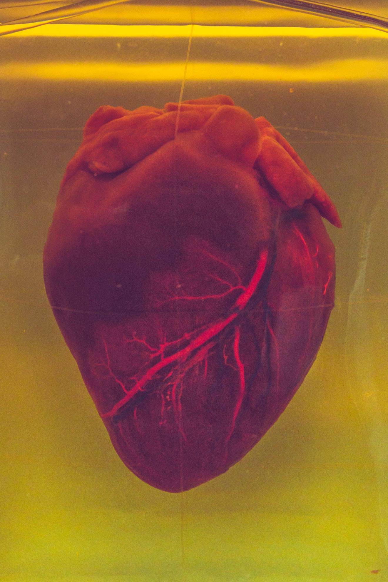 Einsatz von Bioprinting Einsatz von Bioprinting